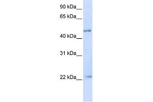WB Suggested Anti-TRIM21 Antibody Titration:  0.