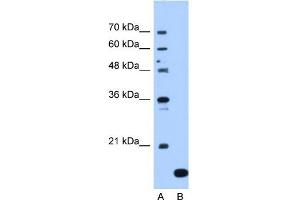 NAT13 antibody used at 1. (NAA50 Antikörper  (C-Term))