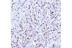 IHC analysis of Cdk2 using anti-Cdk2 antibody (ABIN7602522). (CDK2 Antikörper  (AA 81-298))