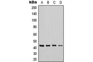Western blot analysis of CHST6 expression in MCF7 (A), Jurkat (B), NS-1 (C), H9C2 (D) whole cell lysates.