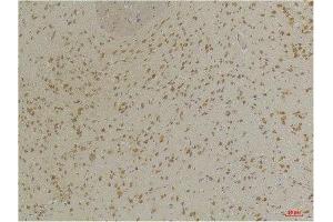 Immunohistochemistry (IHC) analysis of paraffin-embedded Mouse Brain Tissue using GABA A Receptor alpha3 Rabbit Polyclonal Antibody diluted at 1:200. (GABRA3 Antikörper)
