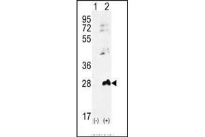 Western blot analysis of AK1 (arrow) using rabbit polyclonal AK1 Antibody (S45) (ABIN392794 and ABIN2842231). (Adenylate Kinase 1 Antikörper  (N-Term))