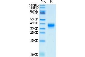 Human Fc gamma RIIA/CD32a (H167) on Tris-Bis PAGE under reduced condition. (FCGR2A Protein (His-Avi Tag,Biotin))