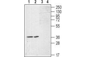 Sphingosine-1-Phosphate Receptor 1 (S1PR1) peptide