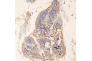 IHC analysis of TRAF6 using anti-TRAF6 antibody (ABIN7600026).