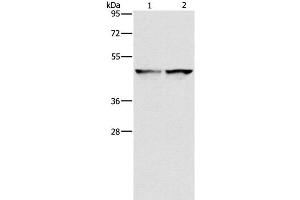 Western Blot analysis of 231 and hela cell using IDH1 Polyclonal Antibody at dilution of 1:550 (IDH1 Antikörper)