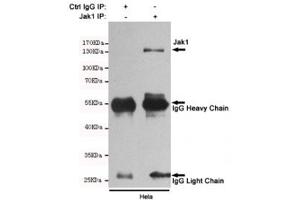 Immunoprecipitation and western blot of HeLa cell lysate using the JAK1 antibody. (JAK1 Antikörper)