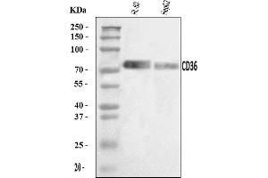 Western blot analysis of CD36 using anti-CD36 antibody (ABIN7600781).
