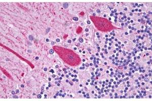 Anti-CES2 / Esterase antibody IHC staining of human brain, cerebellum, purine.