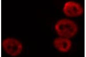 ABIN6269376 staining HeLa cells by IF/ICC. (CAMK4 Antikörper  (Internal Region))