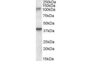Image no. 1 for anti-Glutamate Receptor, Ionotropic, Kainate 3 (GRIK3) (Internal Region) antibody (ABIN375008) (GRIK3 Antikörper  (Internal Region))