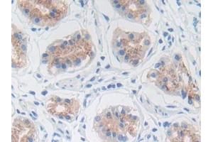 DAB staining on IHC-P; Samples: Human Stomach Tissue (MMP3 Antikörper  (AA 289-452))