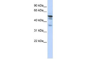 NMT1 antibody used at 1 ug/ml to detect target protein. (NMT1 Antikörper  (N-Term))