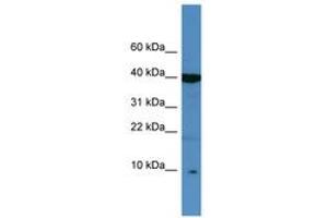 Image no. 1 for anti-serine Peptidase Inhibitor, Kazal Type 6 (SPINK6) (C-Term) antibody (ABIN6746431) (SPINK6 Antikörper  (C-Term))