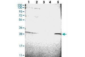 Western blot analysis of Lane 1: RT-4, Lane 2: U-251 MG, Lane 3: Human Plasma, Lane 4: Liver, Lane 5: Tonsil with ERGIC1 polyclonal antibody  at 1:250-1:500 dilution. (ERGIC1 Antikörper)