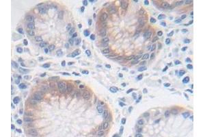 Immunohistochemistry (IHC) image for anti-Fibroblast Growth Factor Receptor-Like 1 (FGFRL1) (AA 168-378) antibody (ABIN7430033)