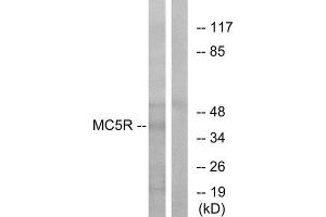 Western Blotting (WB) image for anti-Melanocortin 5 Receptor (MC5R) (C-Term) antibody (ABIN1853066) (MC5 Receptor Antikörper  (C-Term))