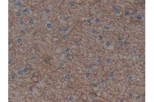 Detection of AQP4 in Human Brain Tissue using Polyclonal Antibody to Aquaporin 4 (AQP4) (Aquaporin 4 Antikörper  (AA 178-317))