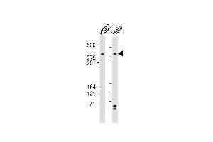 All lanes : Anti-TRR Antibody (C-term) at 1:2000 dilution Lane 1: K562 whole cell lysates Lane 2: Hela whole cell lysates Lysates/proteins at 20 μg per lane. (TRRAP Antikörper  (C-Term))