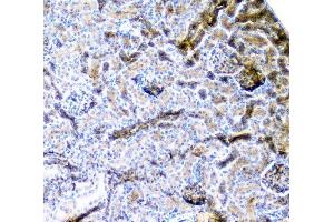 IHC analysis of CD2AP using anti-CD2AP antibody (ABIN6719544). (CD2AP Antikörper  (AA 253-337))