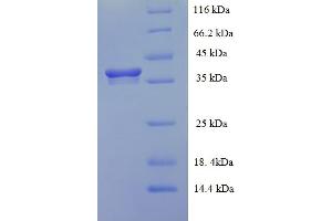 SDS-PAGE (SDS) image for Heme Binding Protein 2 (HEBP2) (AA 2-205) protein (His-SUMO Tag) (ABIN4974502)
