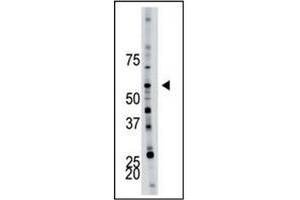Image no. 1 for anti-6-phosphofructo-2-Kinase/fructose-2,6-Biphosphatase 4 (PFKFB4) (AA 274-303) antibody (ABIN360670) (PFKFB4 Antikörper  (AA 274-303))