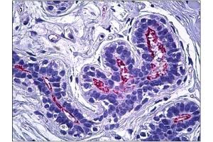 Human Breast, Epithelium: Formalin-Fixed, Paraffin-Embedded (FFPE)