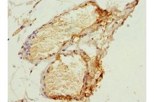 Immunohistochemistry of paraffin-embedded human plasma tissue using ABIN7155026 at dilution of 1:100