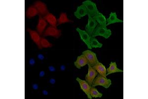 ABIN6258220 and ABIN6275062 staining Hela cells by IF/ICC. (GNPAT Antikörper  (Internal Region))