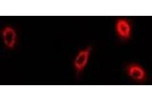 Immunofluorescent analysis of sPLA2-IID staining in U2OS cells. (PLA2G2D Antikörper)