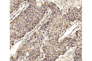IHC analysis of SCRN1 using anti-SCRN1 antibody (ABIN7602923). (Secernin 1 Antikörper  (C-Term))