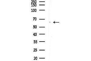 Western blot analysis of lysates from COLO205 cells, using Phospho-c-Fos (Ser32) Antibody at 1/1000 dilution.