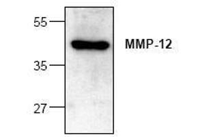 Image no. 1 for anti-Matrix Metallopeptidase 12 (Macrophage Elastase) (MMP12) antibody (ABIN127325) (MMP12 Antikörper)