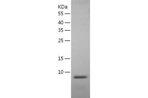 Defensin beta 3 Protein (DEFB3) (AA 23-63) (His tag)