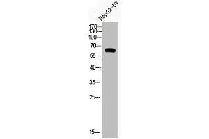 Western Blot analysis of HEPG2-UV cells using Acetyl-Cortactin (K235) Polyclonal Antibody (Cortactin Antikörper  (acLys235))