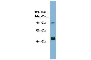 Western Blot showing MAML3 antibody used at a concentration of 1-2 ug/ml to detect its target protein. (MAML3 Antikörper  (Middle Region))