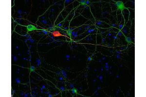 Indirect immunostaining of methanol fixed rat hippocampus neurons with anti-calretinin (dilution 1 : 500; red) and mouse anti-MAP 2 (, dilution 1 : 1000; green). (Calretinin Antikörper)