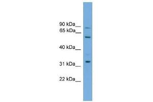 Western Blot showing PTDSS2 antibody used at a concentration of 1-2 ug/ml to detect its target protein. (PTDSS2 Antikörper  (Middle Region))