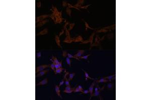 Immunofluorescence (IF) image for anti-serpin Peptidase Inhibitor, Clade B (Ovalbumin), Member 9 (SERPINB9) (AA 1-376) antibody (ABIN6147596)