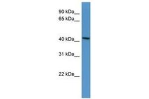 Image no. 1 for anti-UDP-Gal:betaGlcNAc beta 1,4- Galactosyltransferase, Polypeptide 5 (B4GALT5) (AA 311-360) antibody (ABIN6746272)