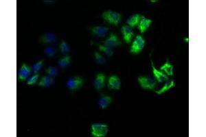 Immunofluorescence staining of Hela cells with ABIN7167999 at 1:100, counter-stained with DAPI. (ROCK1 Antikörper  (AA 405-668))