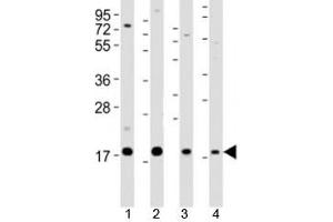 Western blot testing of Shh antibody at 1:2000 dilution. (Sonic Hedgehog Antikörper  (N-Term))