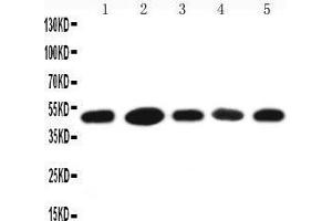 Anti-HSC70 Interacting Protein HIP antibody, Western blotting Lane 1: A431 Cell Lysate Lane 2: HELA Cell Lysate Lane 3: 293T Cell Lysate Lane 4: JURKAT Cell Lysate Lane 5: MCF-7 Cell Lysate