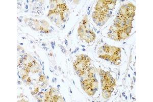 Immunohistochemistry of paraffin-embedded Human stomach using Endothelin 1 Polyclonal Antibody at dilution of 1:100 (40x lens).