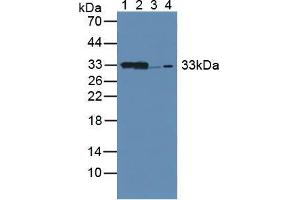 Western blot analysis of (1) Mouse Kidney Tissue, (2) Mouse Liver Tissue, (3) Rat Kidney Tissue and (4) Human 293T Cells. (CBR1 Antikörper  (AA 66-271))