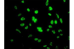 Immunofluorescence of monoclonal antibody to ID1 on HeLa cell. (ID1 Antikörper  (AA 1-155))