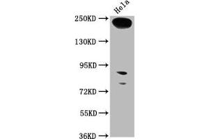 Western Blot Positive WB detected in: Hela whole cell lysate All lanes: RTTN antibody at 1:1000 Secondary Goat polyclonal to rabbit IgG at 1/50000 dilution Predicted band size: 249, 68, 246, 99 kDa Observed band size: 249 kDa (Rotatin (RTTN) (AA 1509-1603) Antikörper)
