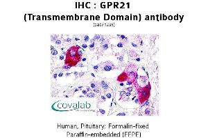 Image no. 2 for anti-G Protein-Coupled Receptor 21 (GPR21) antibody (ABIN1735029) (GPR21 Antikörper)