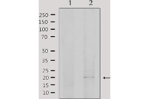 Western blot analysis of extracts from 293, using EID1 Antibody. (EID1 Antikörper  (Internal Region))