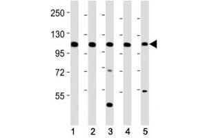 Western blot testing of Mertk antibody at 1:2000 dilution.
